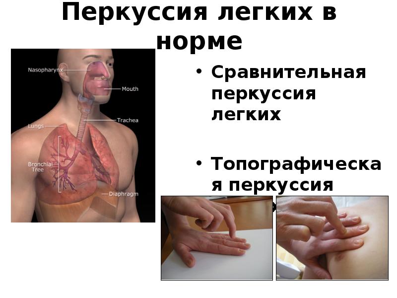 Перкуссия как метод исследования больного. Перкуссия легких в норме и ...