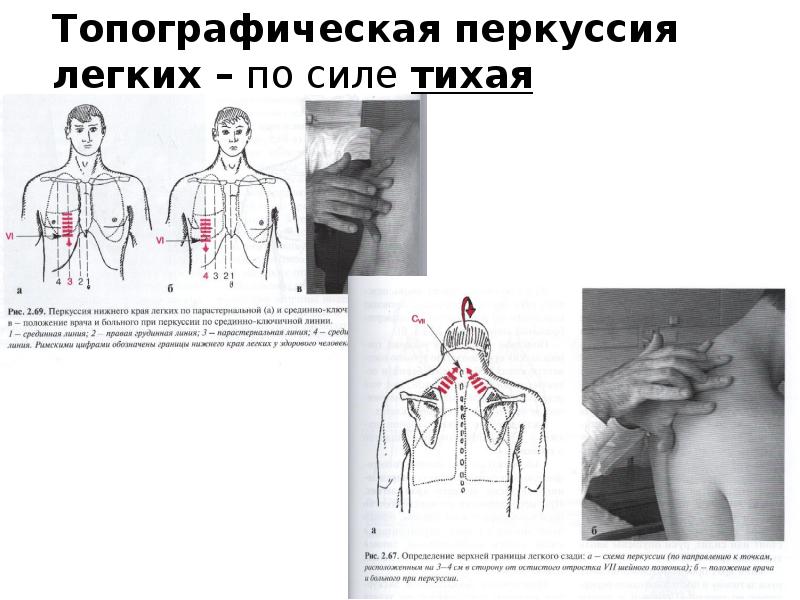 Перкуссия как метод исследования больного. Перкуссия легких в норме и ...