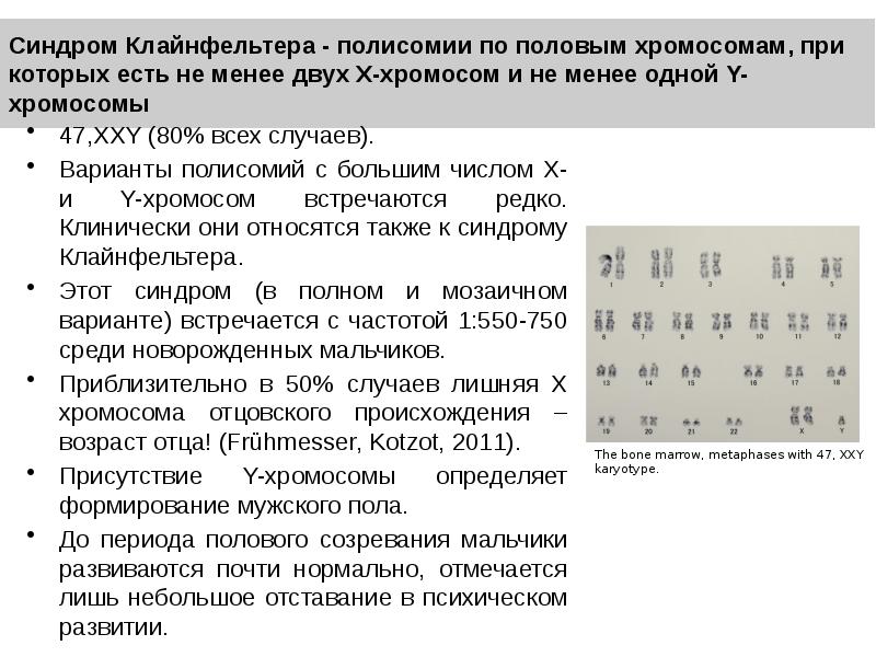 Синдром дауна число половых хромосом