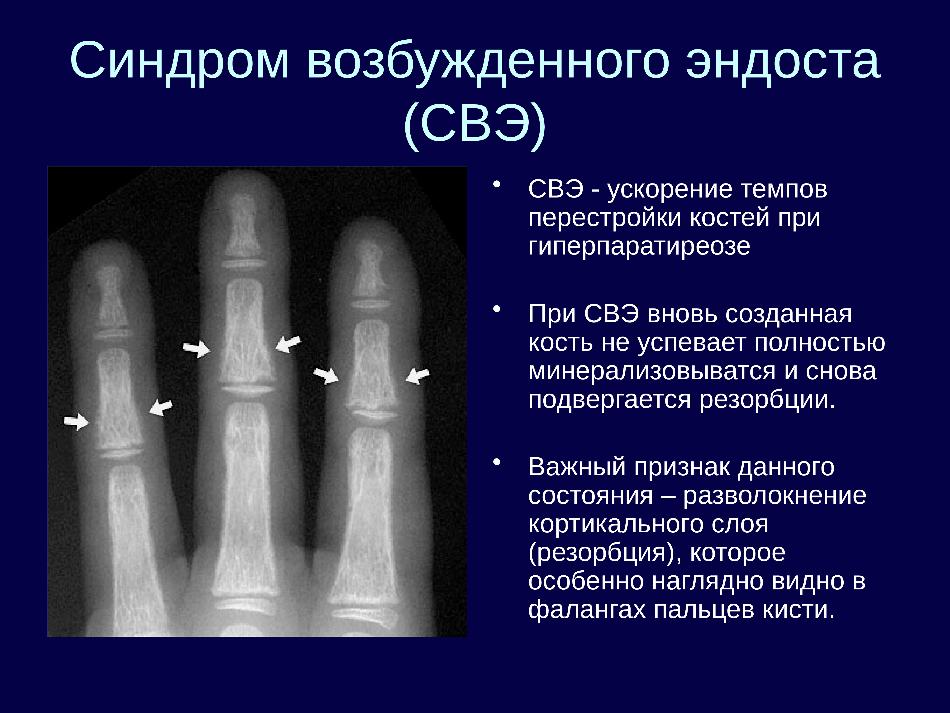 Лучевая диагностика костей презентация