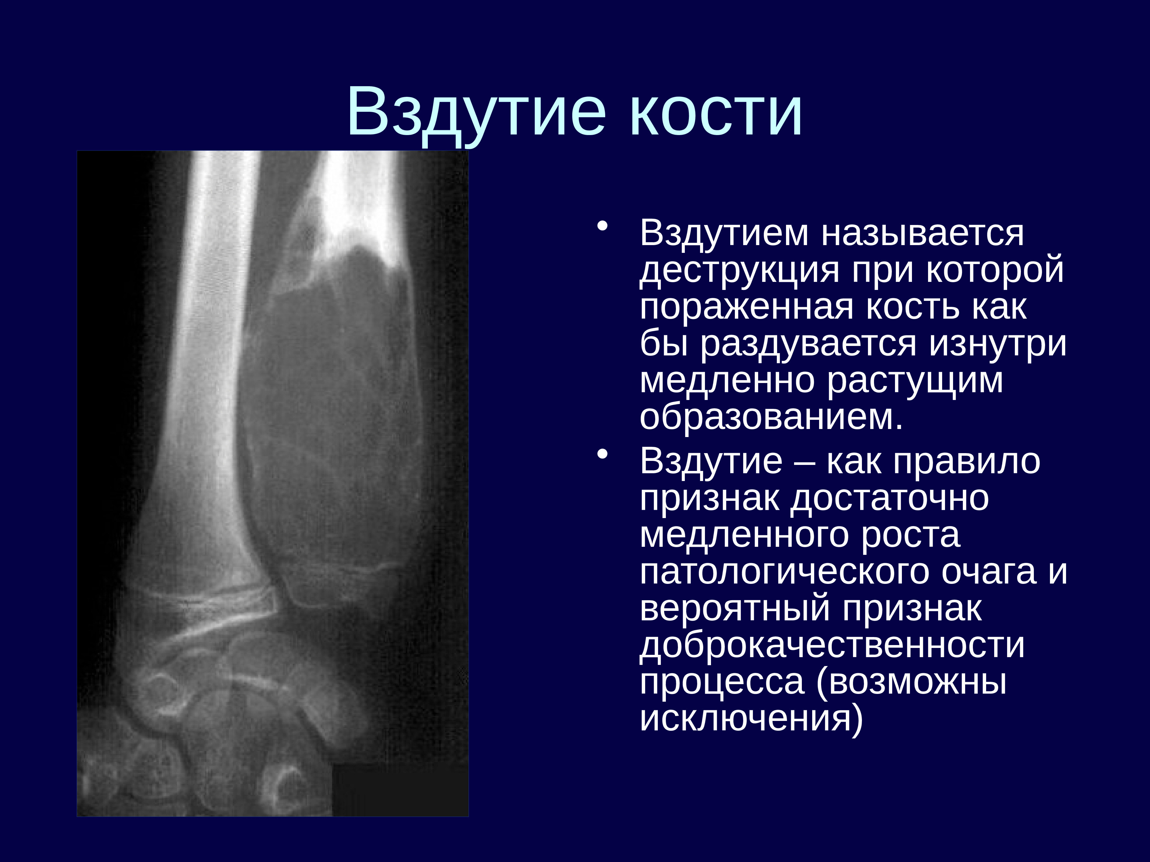 Лучевая диагностика костей презентация