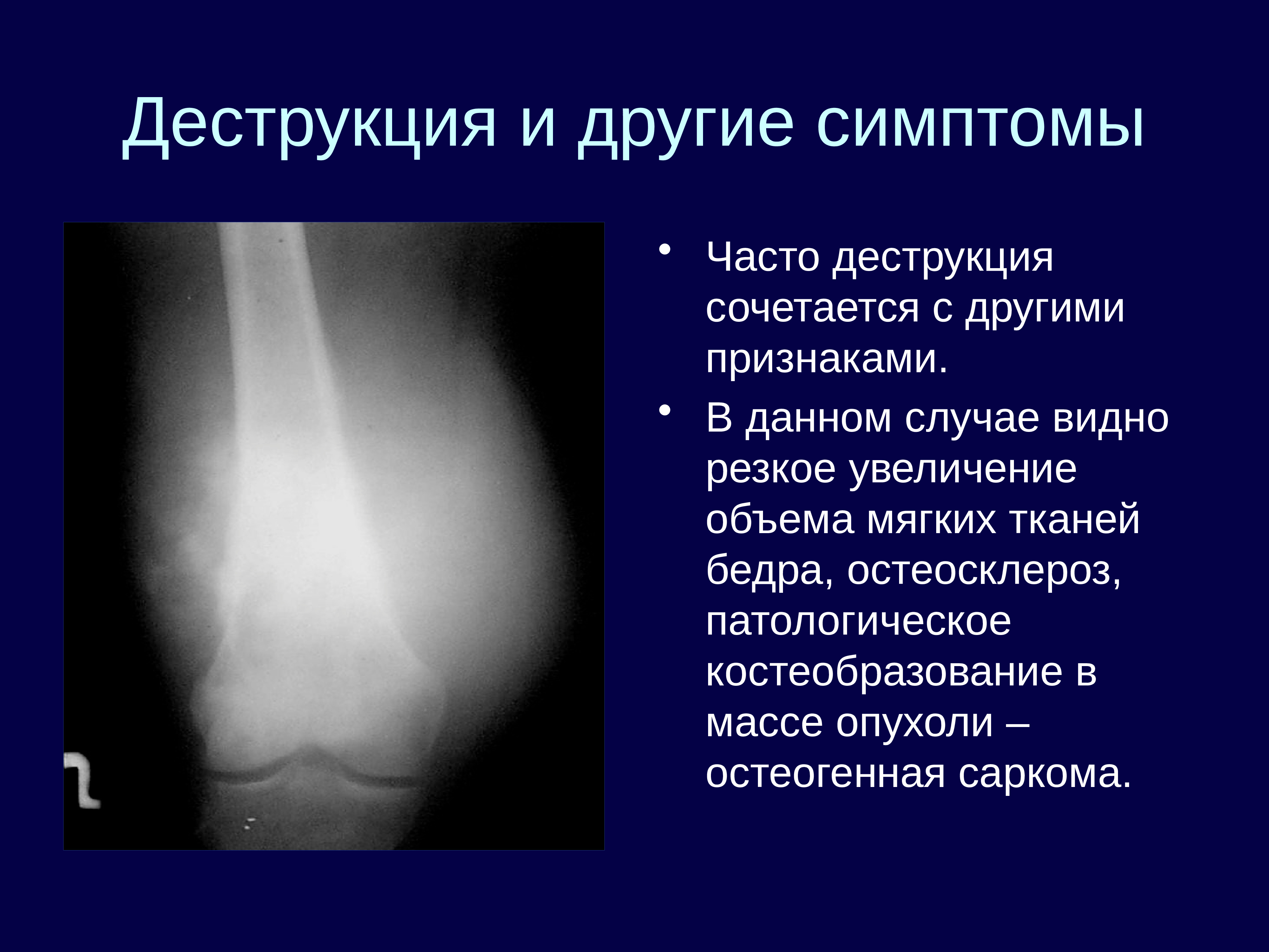 Саркомы мягких тканей презентация