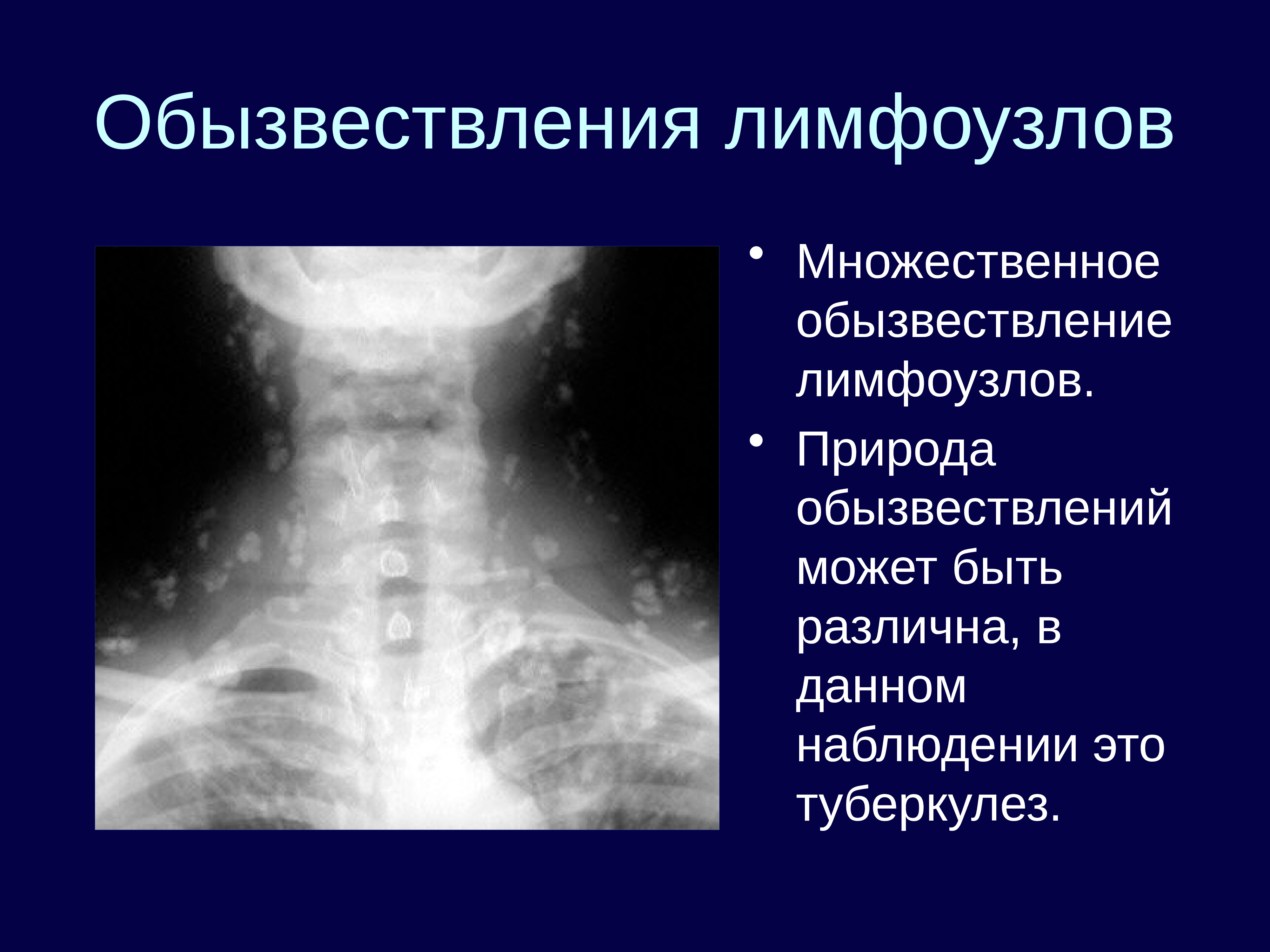 Презентации по лучевой диагностике