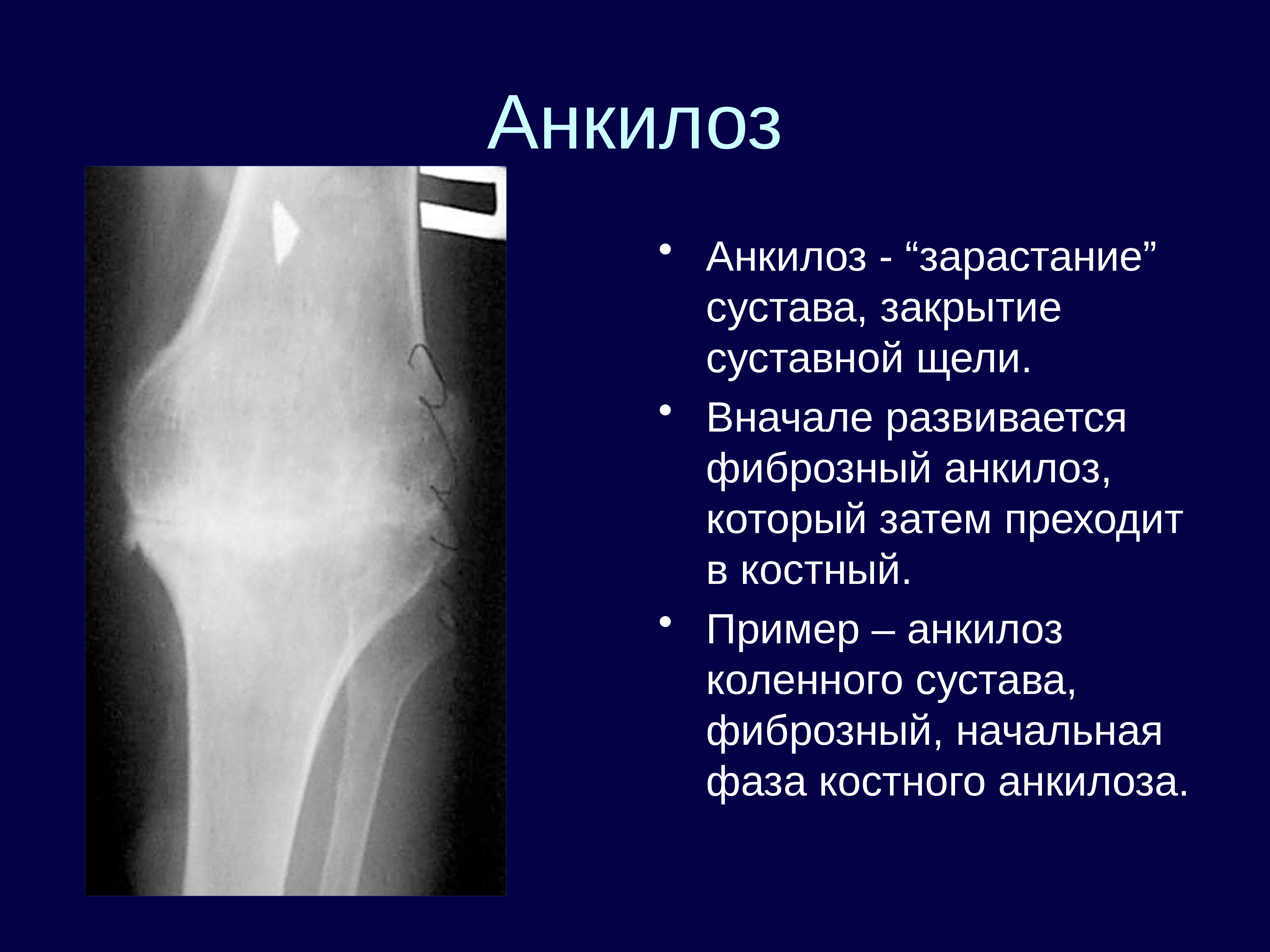 Лучевая диагностика опорно двигательной системы презентация