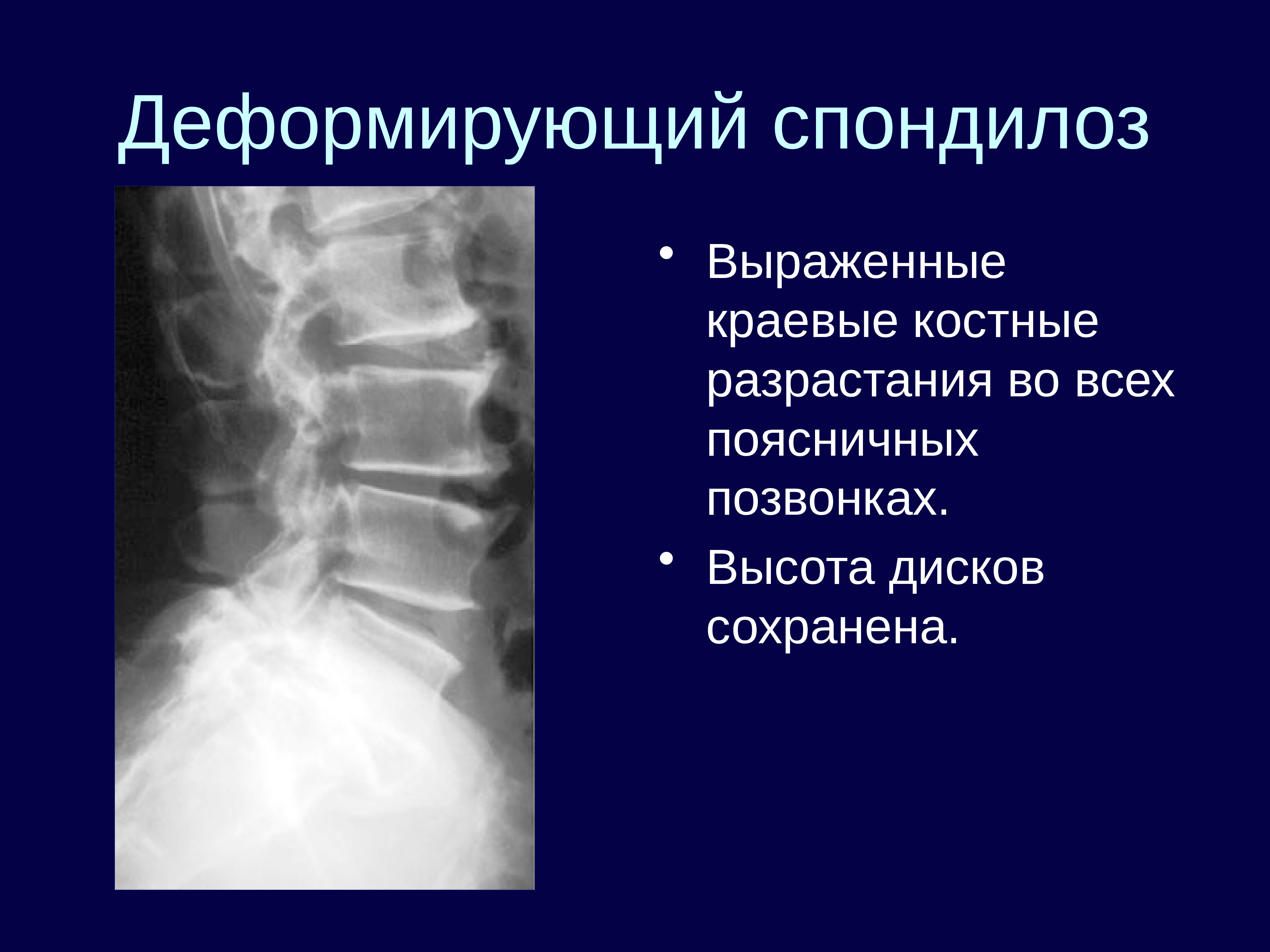 Лучевая диагностика опорно двигательной системы презентация