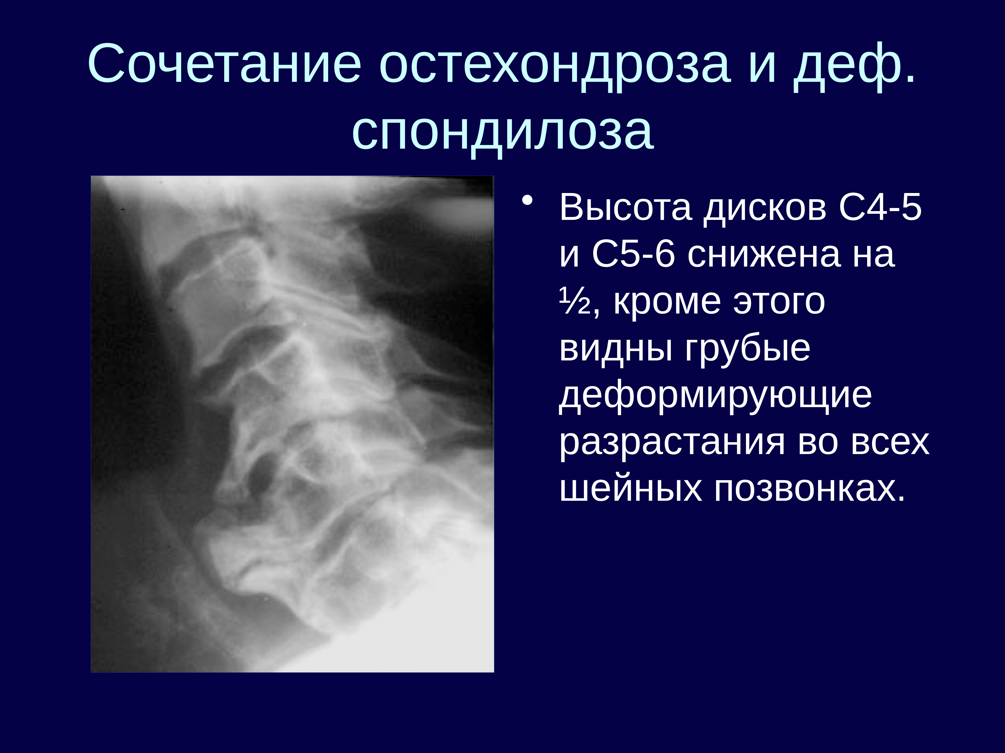 Лучевая диагностика опорно двигательной системы презентация