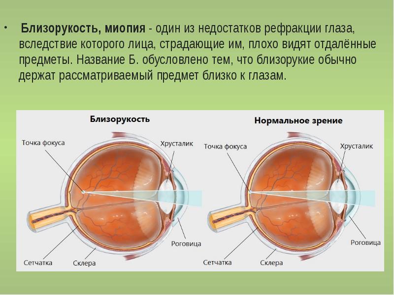 Презентация заболевания глаз 8 класс