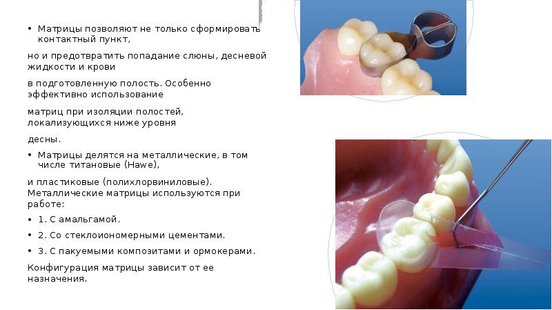 Термопласты в стоматологии презентация