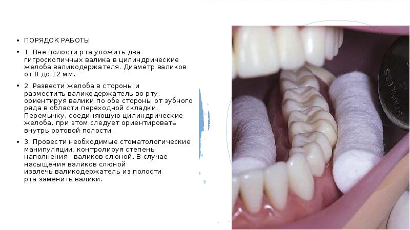 Термопласты в стоматологии презентация