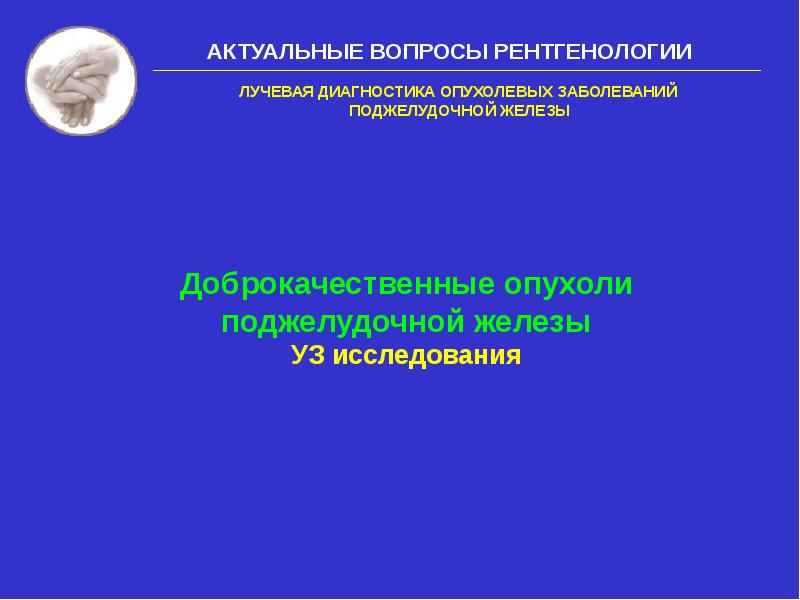 Доброкачественные опухоли поджелудочной железы презентация