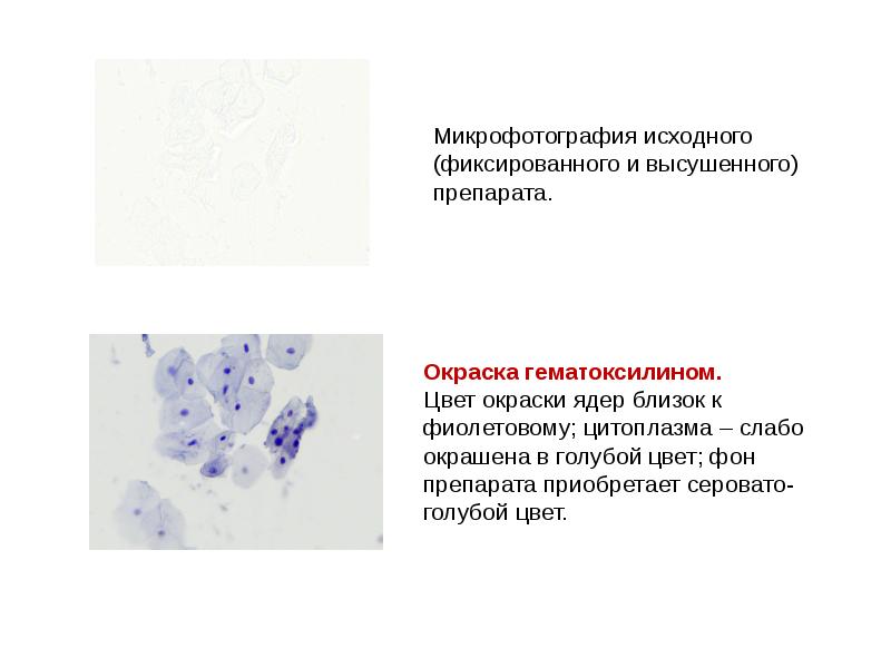 Окраска мазков крови различными методами презентация