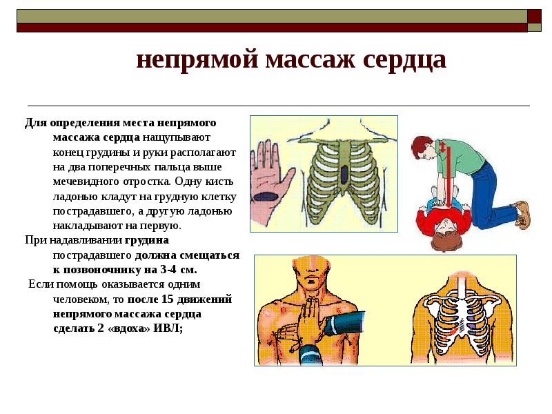 Как следует расположить руки на грудной клетке