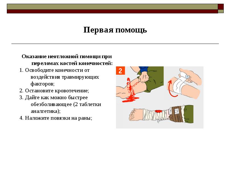 Оказание помощи при переломах. Переломы костей конечностей первая помощь. Первая помощь при переломах конечностей. Неотложная помощь при переломах. Неотложная помощь при переломах конечностей.