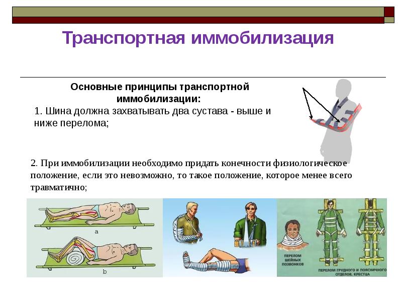 Что такое иммобилизация. Задачи транспортной иммобилизации при переломе костей. Транспортная иммобилизация при переломе конечностей. Принципы транспортной иммобилизации. Алгоритм транспортной иммобилизации при переломах.