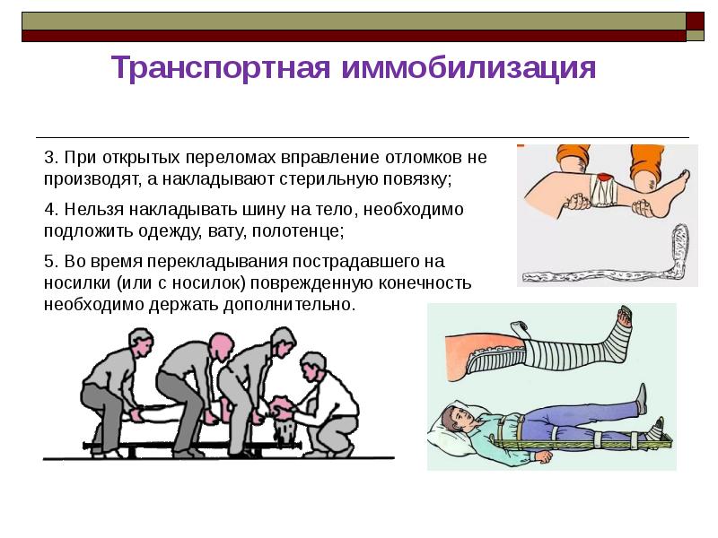 Иммобилизация пострадавшего. Алгоритм транспортной иммобилизации при переломах. Иммобилизация конечности при переломе. Способы иммобилизации при транспортировке переломов костей.. При переломе костей транспортную иммобилизацию проводят.