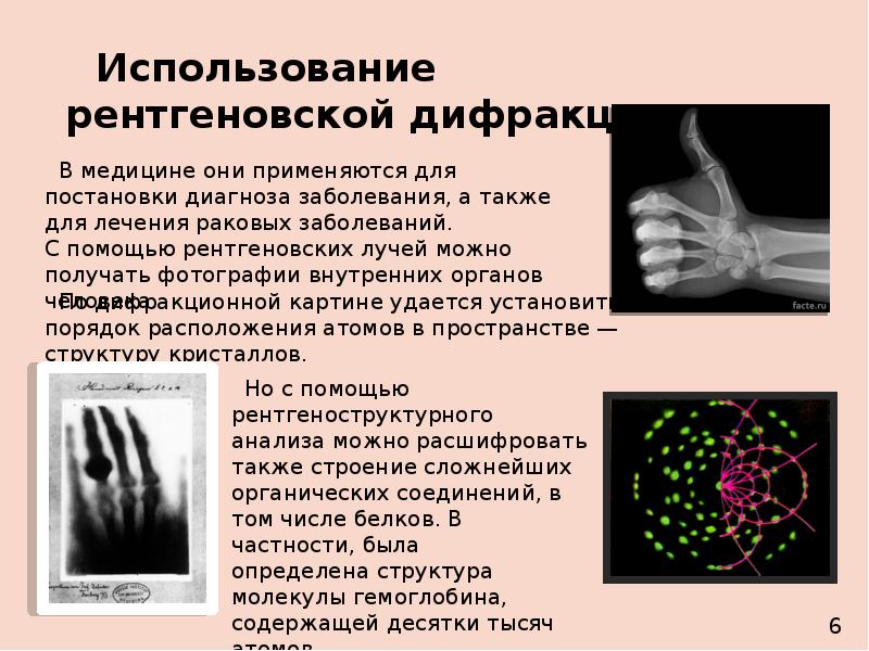 Рентгеноструктурный анализ презентация