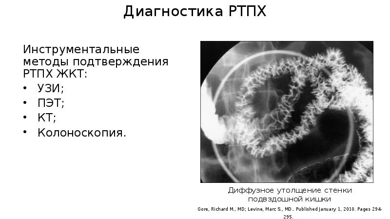 Трансплантат против хозяина презентация