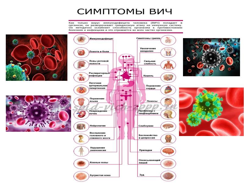 Вич презентация казакша