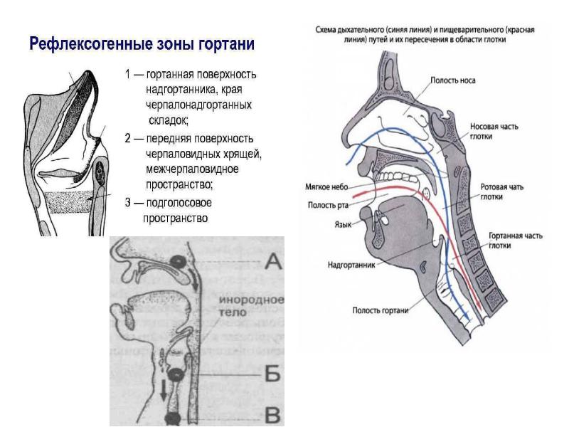 Инородные тела глотки презентация