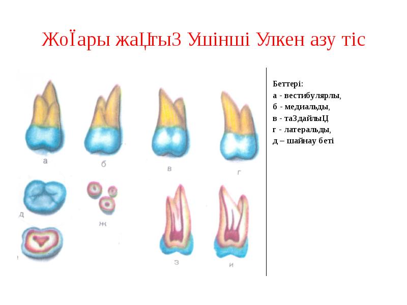 Жоғары жақтың үшінші үлкен азу тіс Жоғары жақтың үшінші үлкен азу тіс