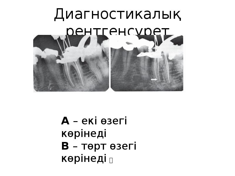 Диагностикалық рентгенсурет Диагностикалық рентгенсурет