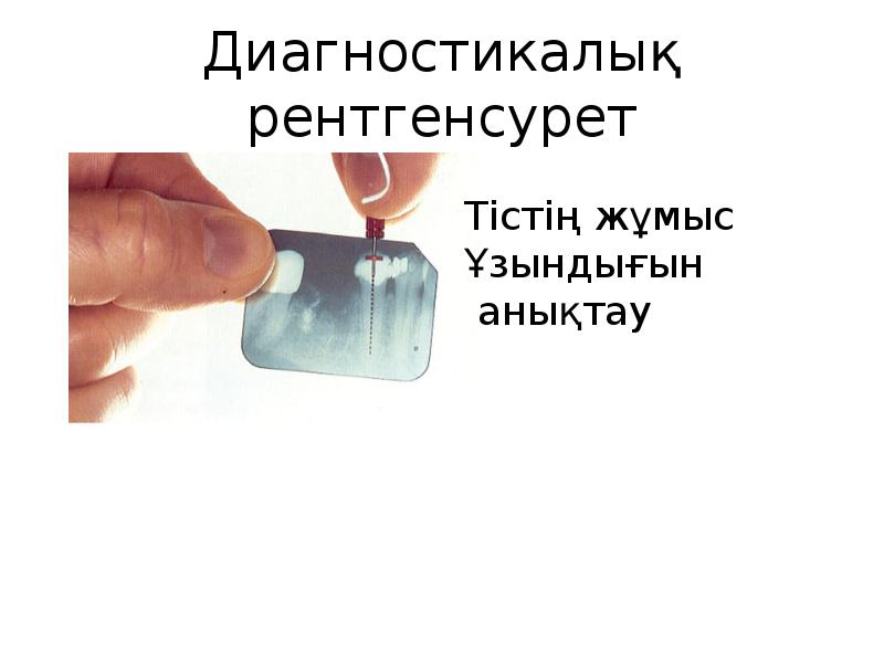 Диагностикалық рентгенсурет Диагностикалық рентгенсурет