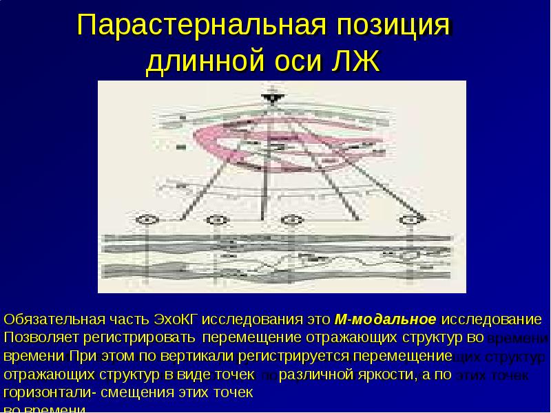 Длинная ось. Парастернальная позиция длинная ось ЭХОКГ. Парастернальная позиция длинная ось. Парастернальная позиция по длинной оси. Парастернальная позиция по длинной оси на ЭХОКГ.