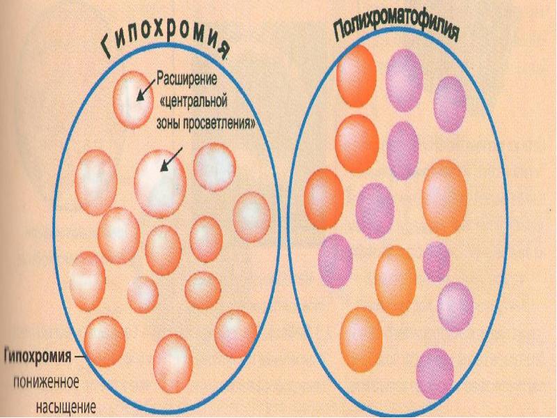 Что такое гипохромия волос