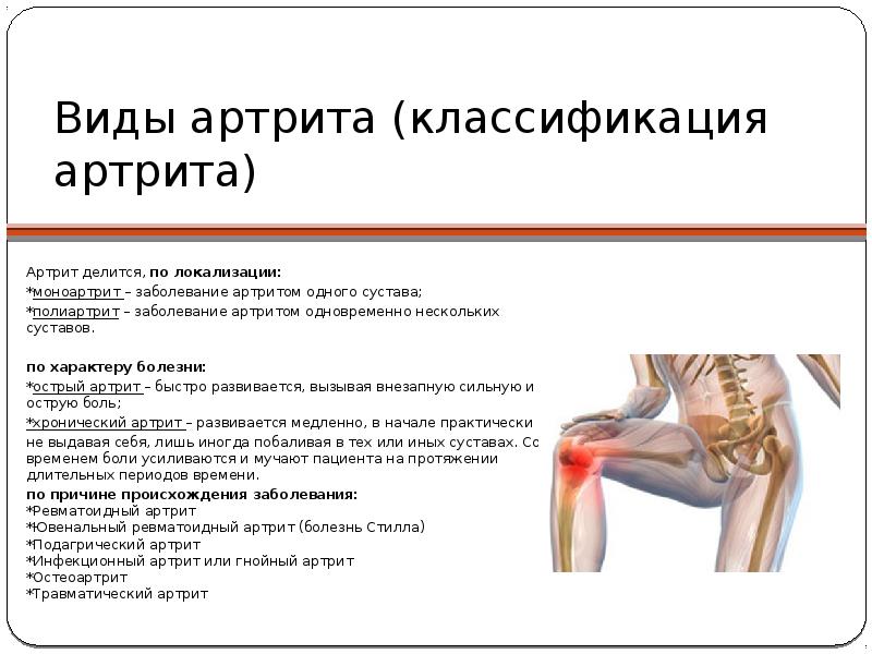 Болезнь суставов артрита. Ревматоидный артрит классификация коленный сустав. Артрит коленного сустава жалобы. Артрит коленного сустава схема. Болезнь суставов название.