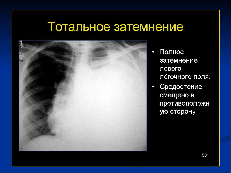 Лучевая диагностика средостения презентация