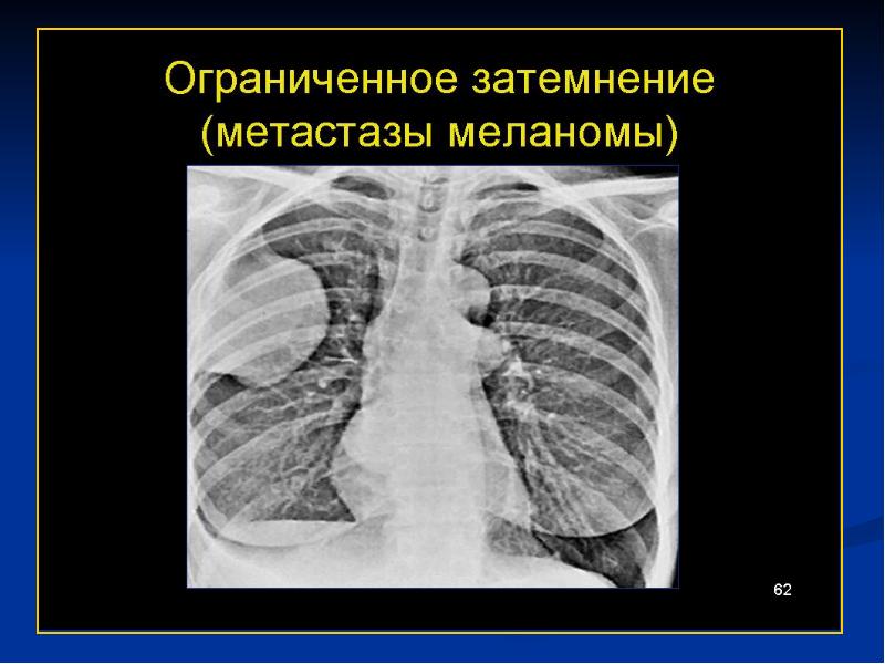 Планарное изображение лучевая диагностика