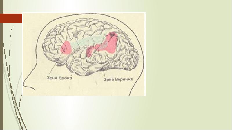 Зона брока и вернике. Зона Брока и Вернике проекция на черепе. Зона Брока на лице. Фото зона Брока и Вернике.