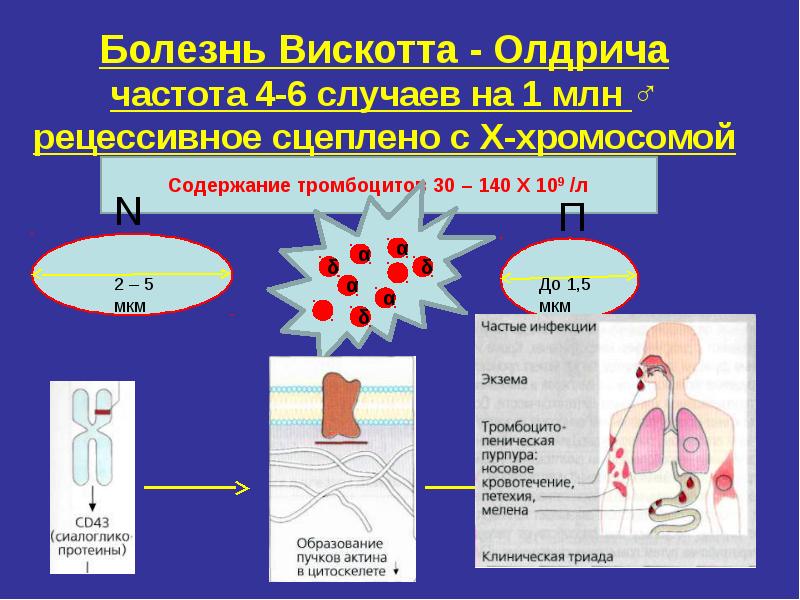 4 6 случаев. Синдром Вискотта Олдрича иммунология. Синдром Вискотта Олдрича патогенез. Иммунодефицит Вискотта-Олдрича.