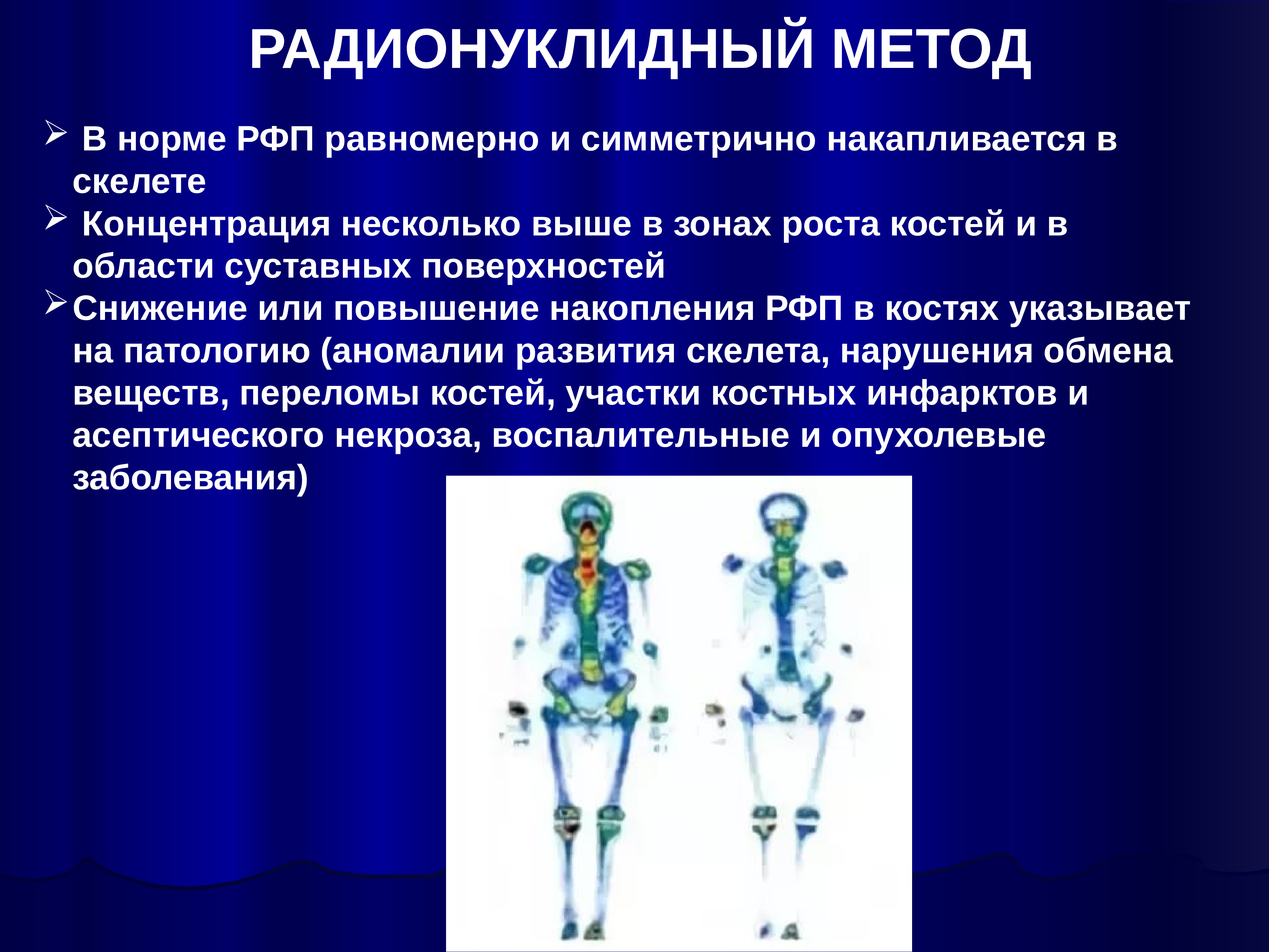 Радионуклидное сканирование. Радионуклидное исследование селезенки. Радионуклидное сканирование. Радионулеотидный метод. Радиоизотопное исследование печени и селезенки.