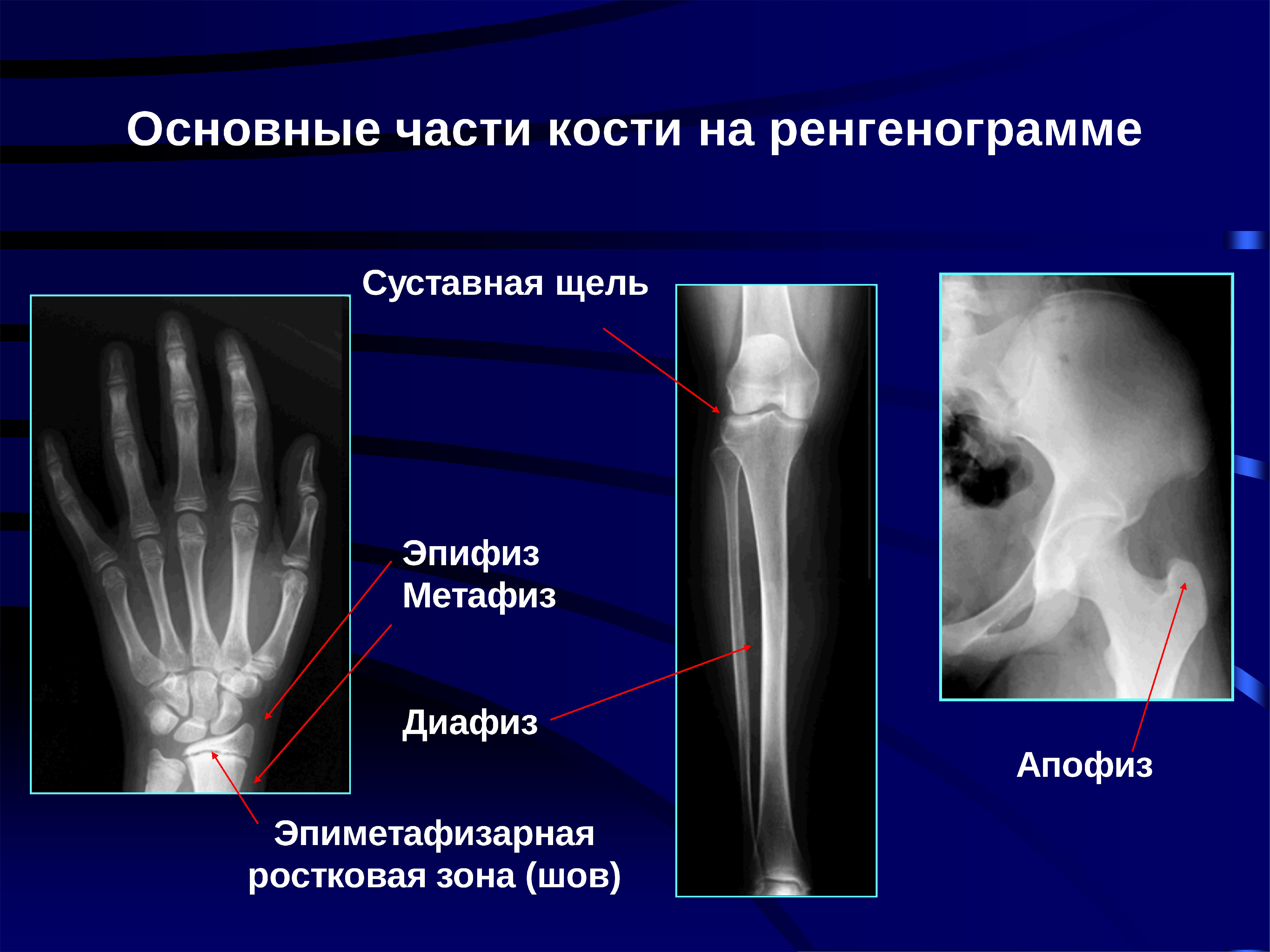 Диагностика костей. Лучевая кость диафиз эпифиз. Метафиз лучевой кости. Метафиз на рентгене. Метафиз кости рентген.