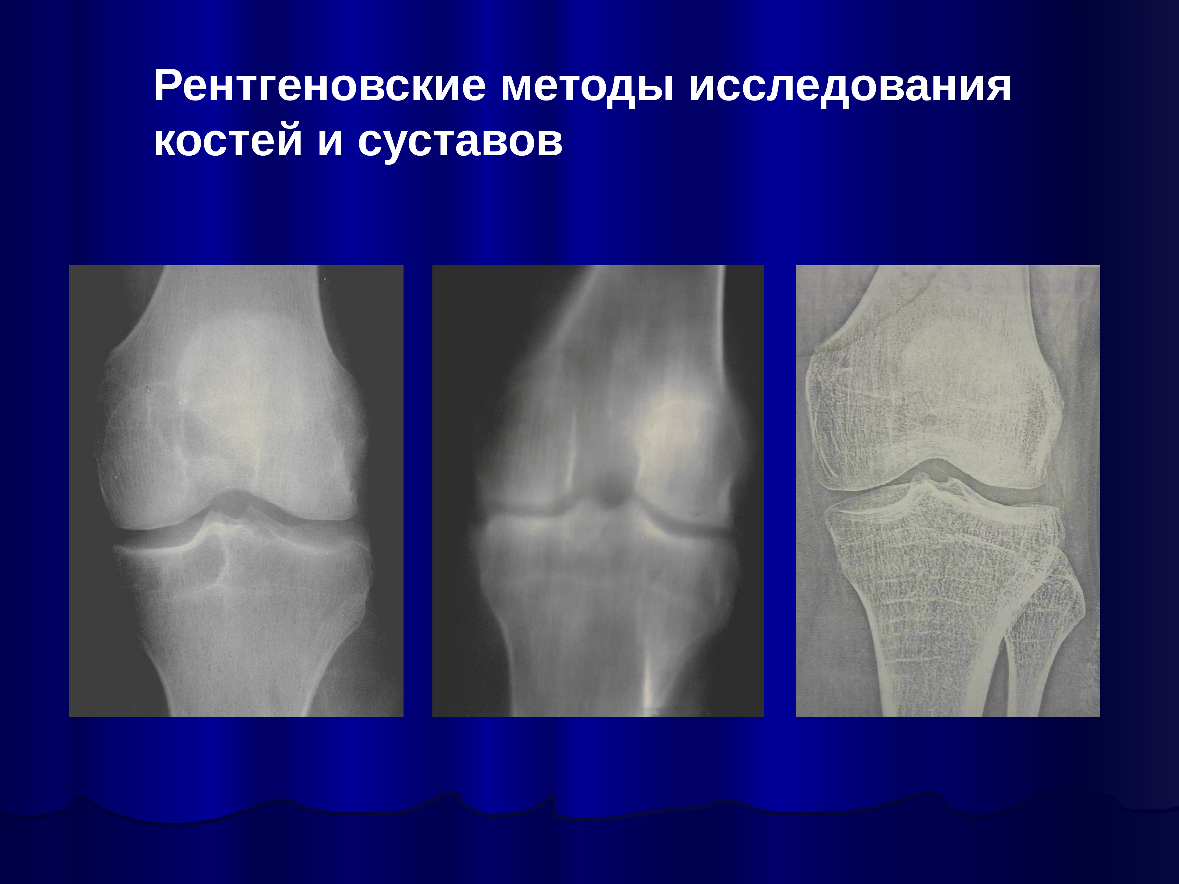 Исследование костей. Рентгенологический метод исследования костей. Рентгенодиагностика костей и суставов. Рентгенологический метод исследования костей и суставов. Рентгеновское изображение сустава.