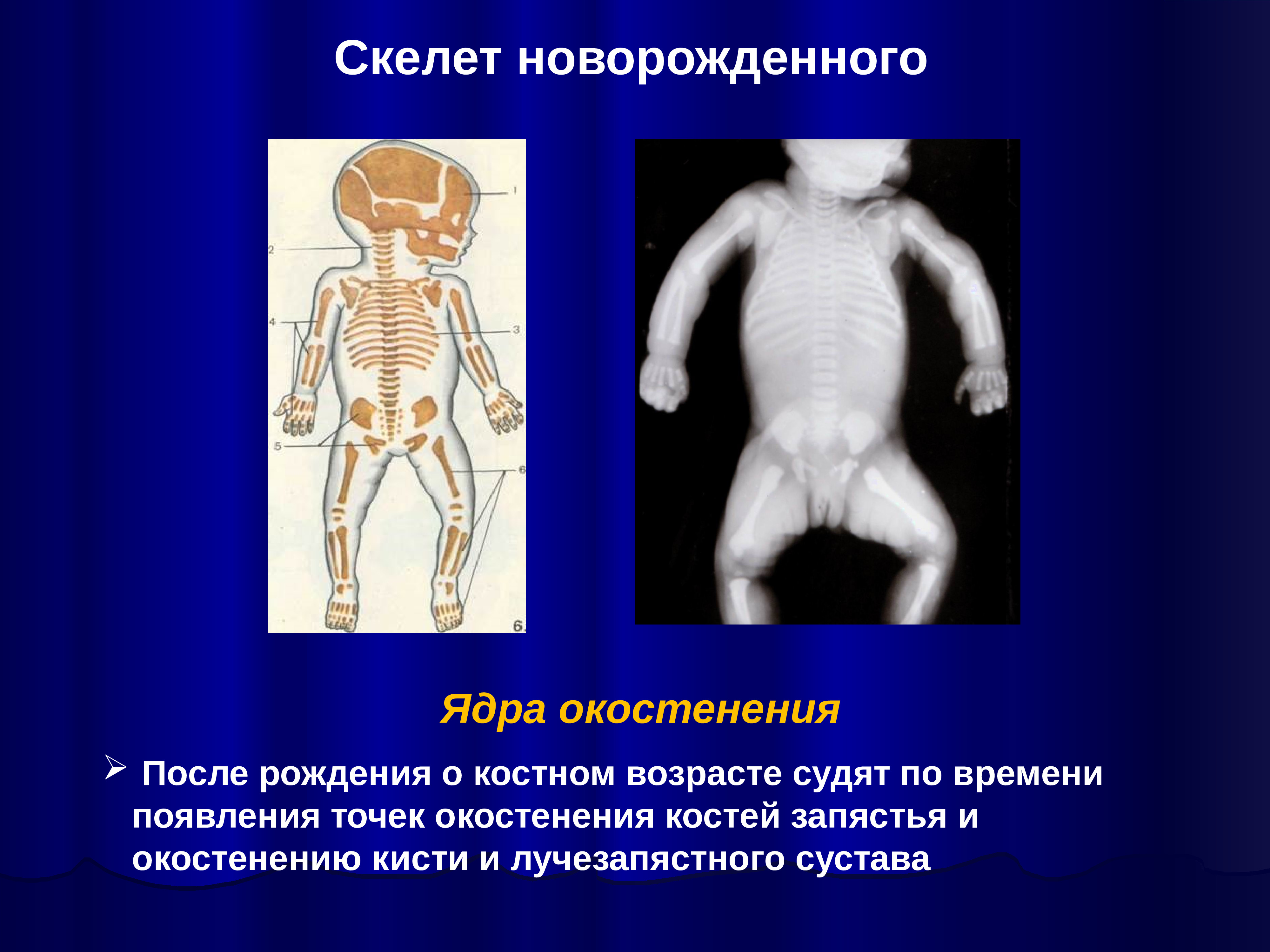 Новорожденный сколько кости