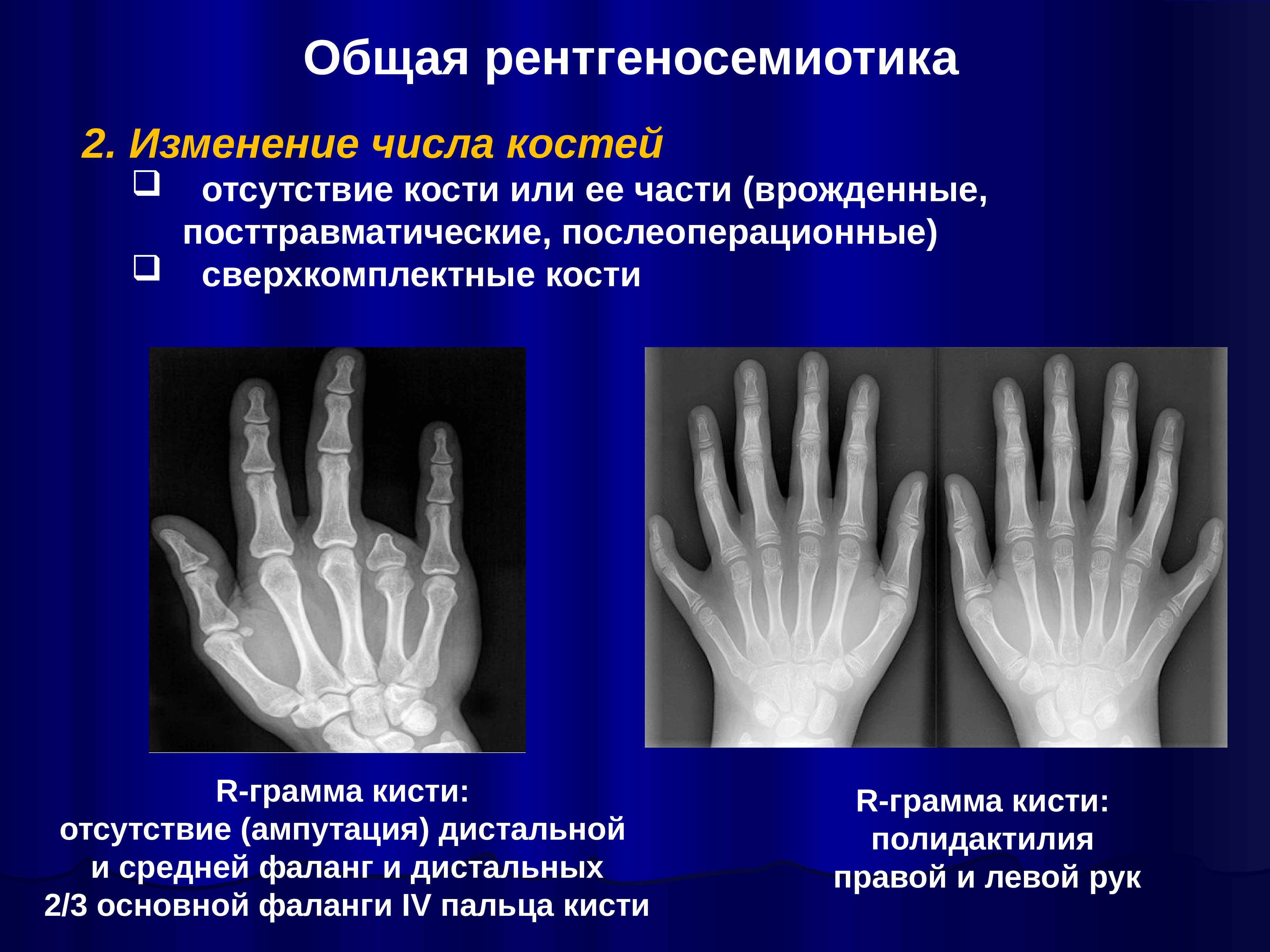 Лучевая диагностика костей презентация