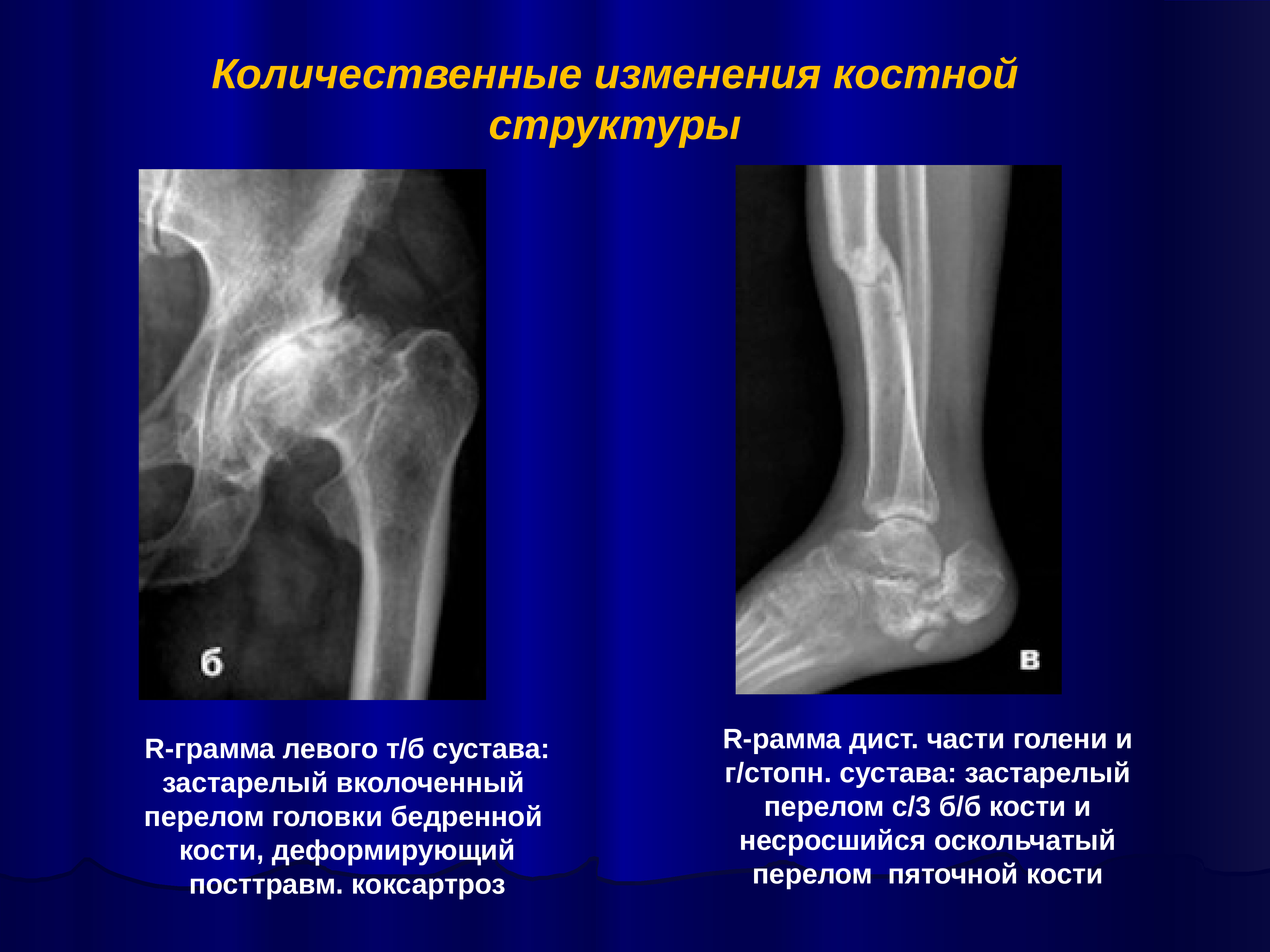 Лучевая диагностика костей презентация