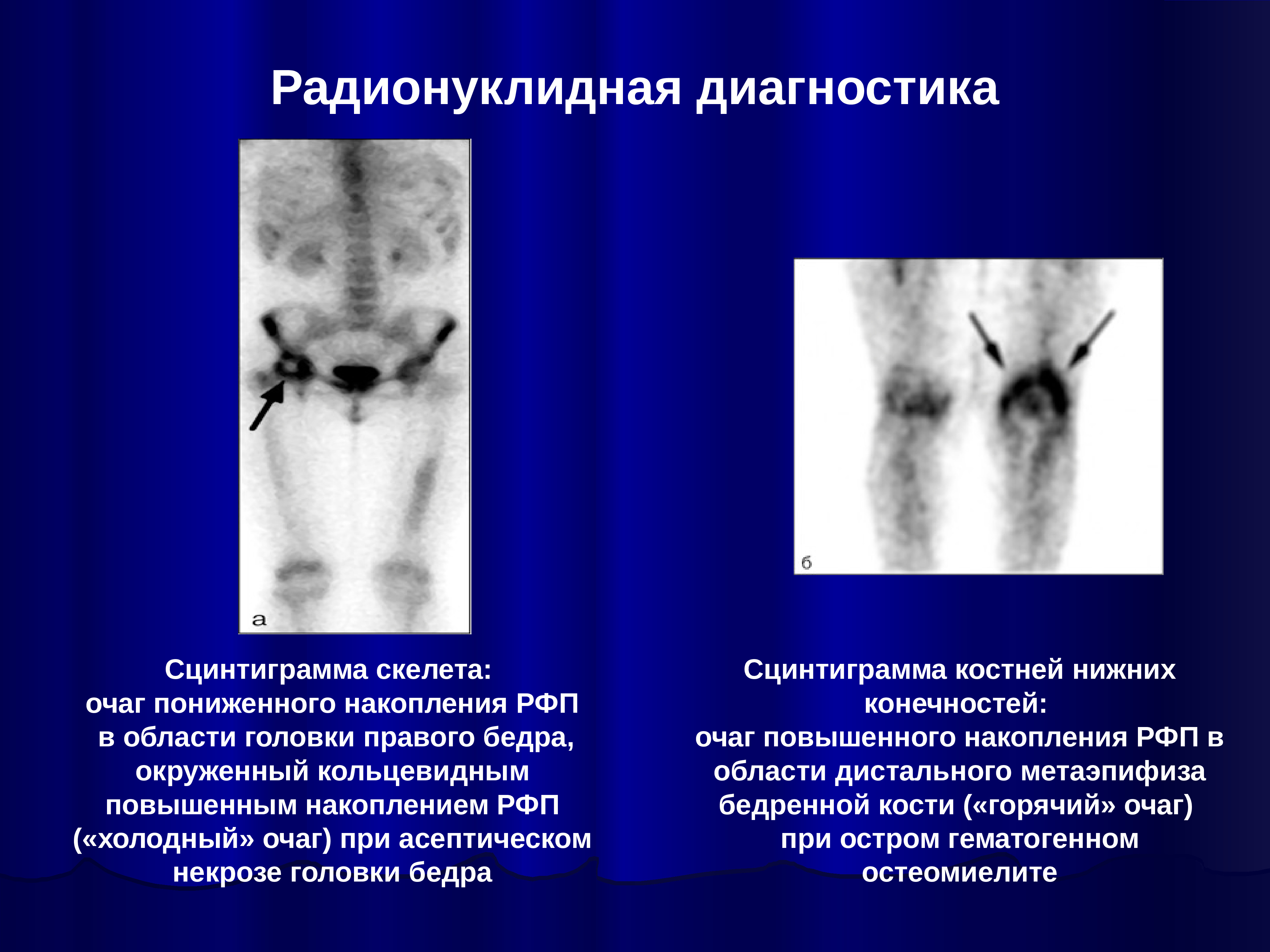 Лучевая диагностика в эндокринологии презентация