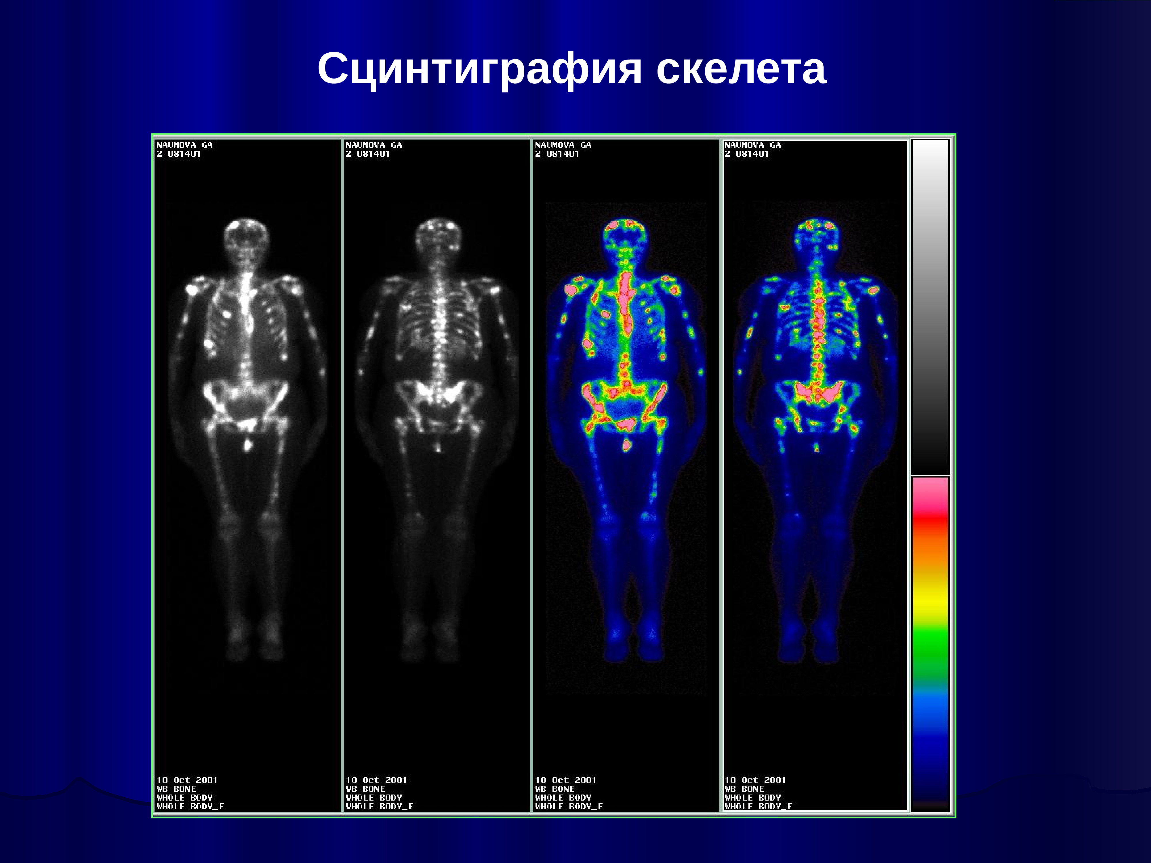 Радионуклидная диагностика фото