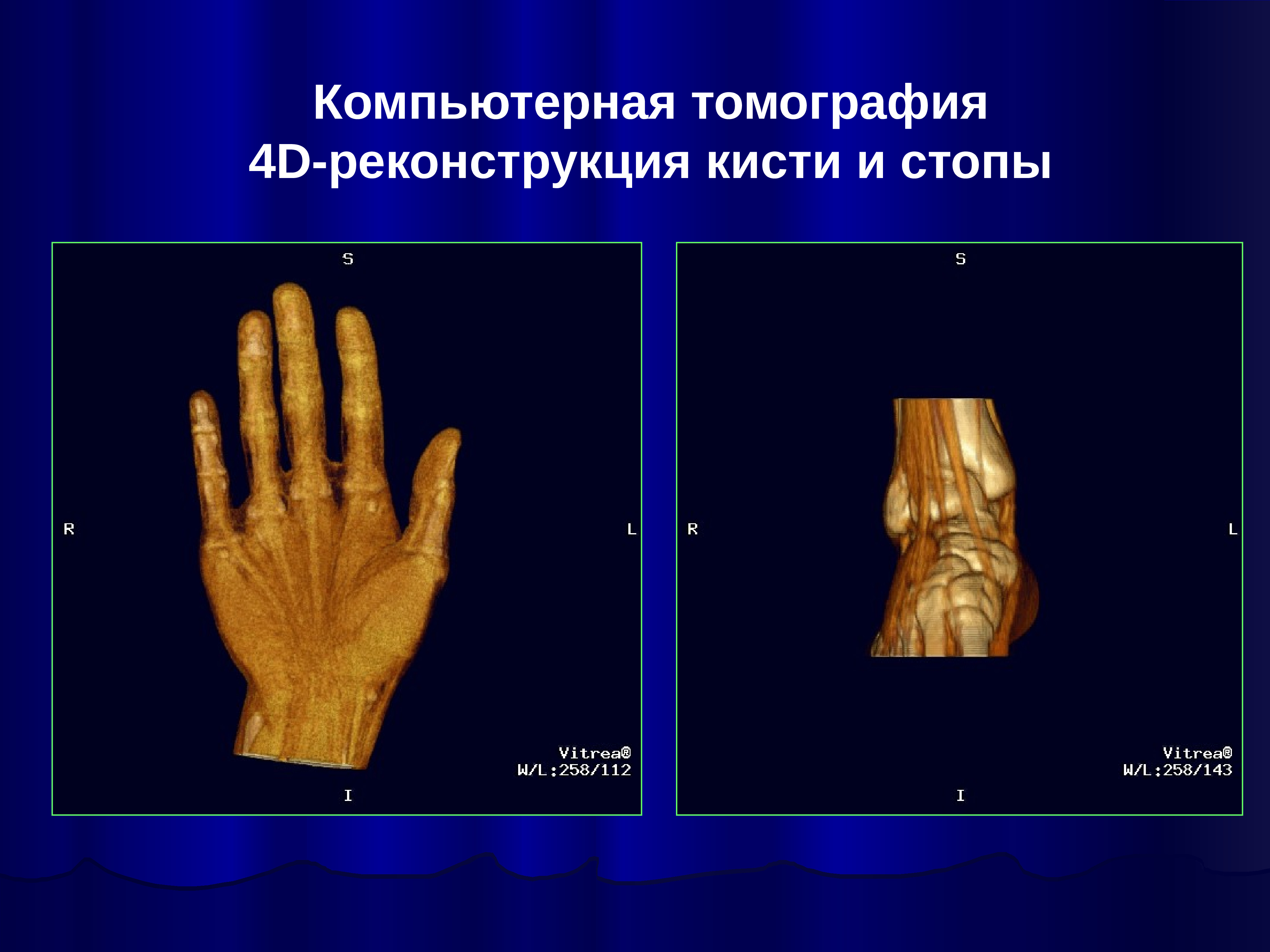 Кт 4 д. Спасибо за внимание лучевая диагностика. Лучевой сустав мед универ. Лучевая экспозиция это.