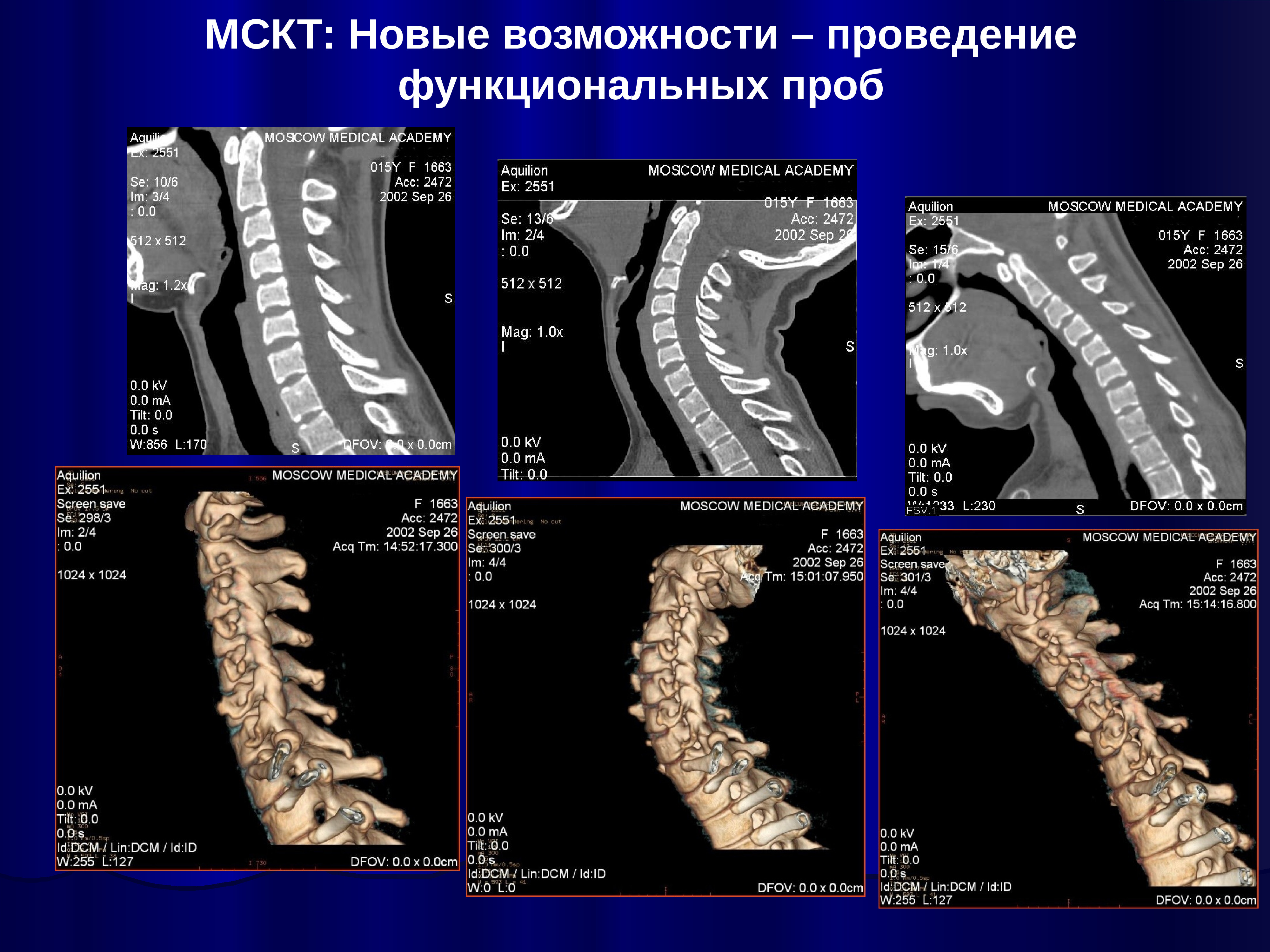 Функциональные пробы позвоночника. МСКТ разметка. Книги по МСКТ.