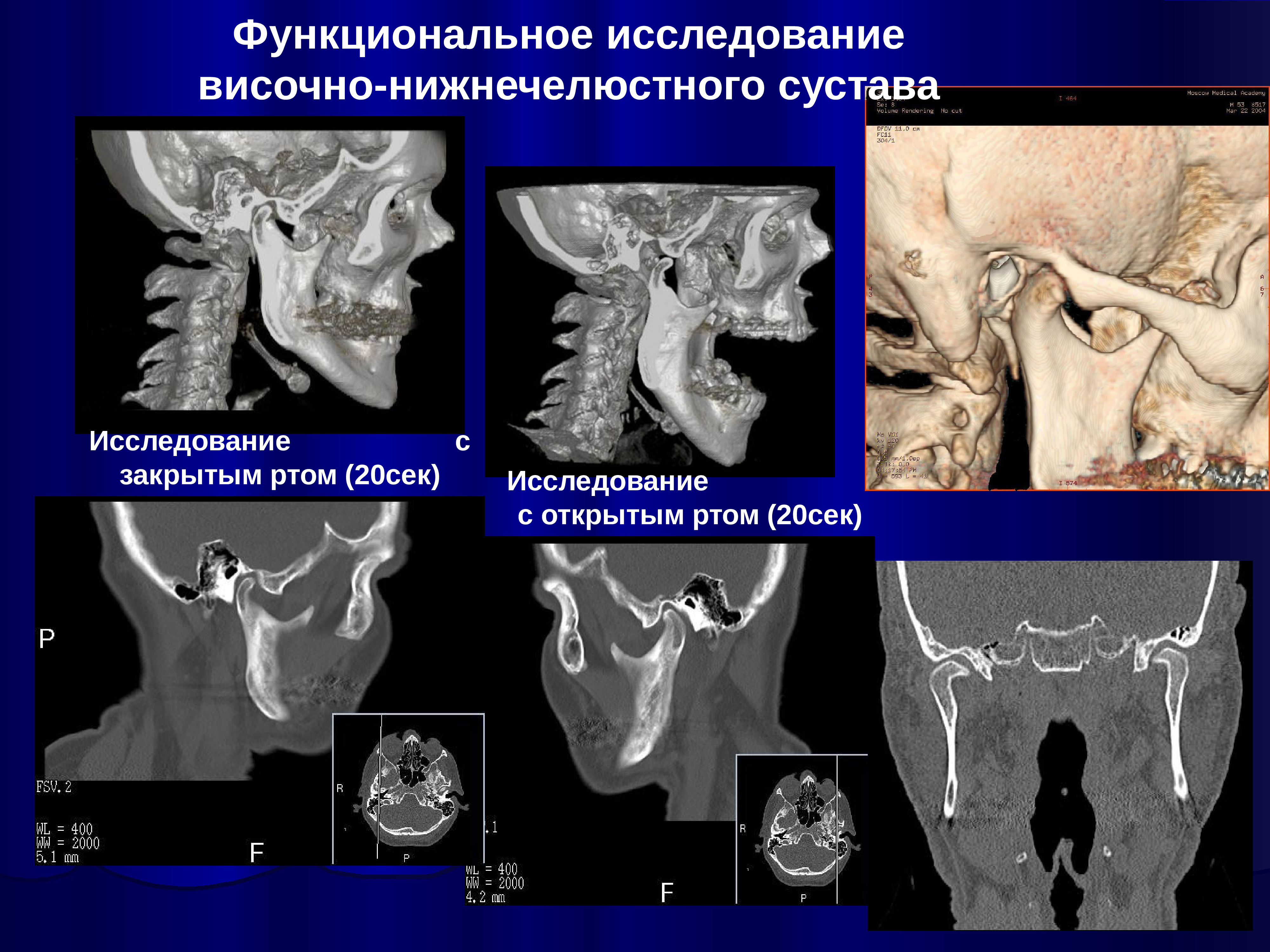 Презентация мрт внчс