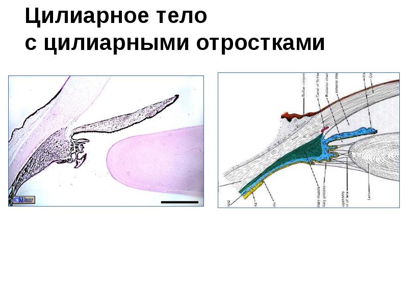 Цилиарное тело с цилиарными отростками Цилиарное тело с цилиарными отростками