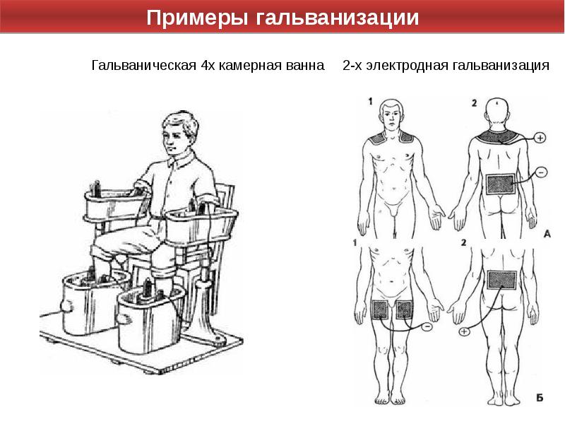 Схема укладок больного на операционном столе при различных операциях