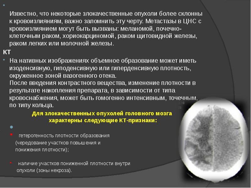 Известно, что некоторые злокачественные опухоли более склонны к кровоизлияниям, важно запомнить Известно, что некоторые злокачественные опухоли более склонны к кровоизлияниям, важно запомнить