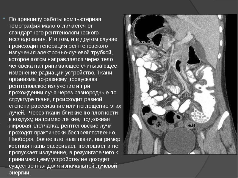 По принципу работы компьютерная томография мало отличается от стандартного рентгенологического исследования. По принципу работы компьютерная томография мало отличается от стандартного рентгенологического исследования.
