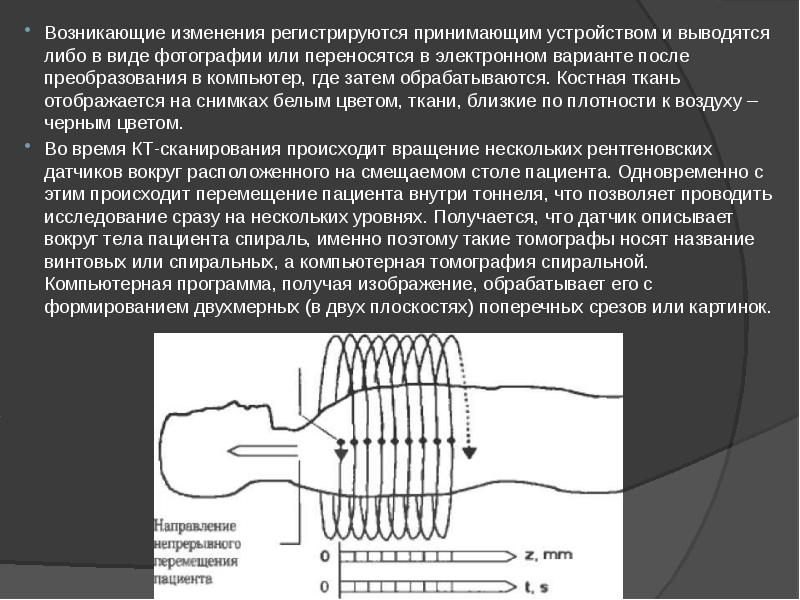 Возникающие изменения регистрируются принимающим устройством и выводятся либо в виде фотографии Возникающие изменения регистрируются принимающим устройством и выводятся либо в виде фотографии