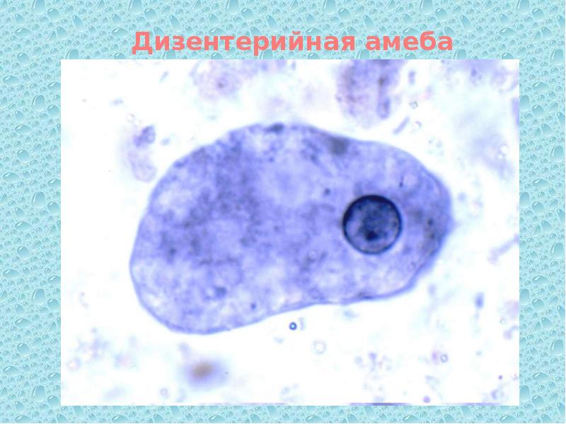 Дизентерийная амеба морфология. Дизентерийная амеба пути заражения. Дизентерийная амеба паразитология. Морфология дизентерийной амебы. Дизентерийная амеба препарат.